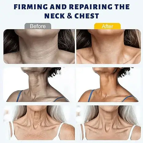 ✨ Instant Neck Lift Cream — Firms Neck Skin & Smooths Wrinkles