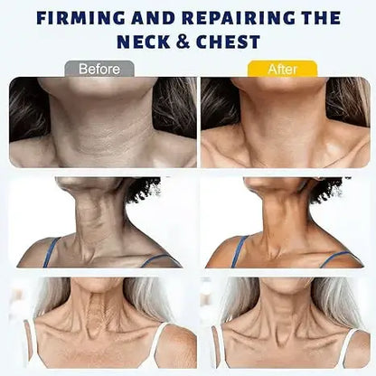✨ Instant Neck Lift Cream — Firms Neck Skin & Smooths Wrinkles